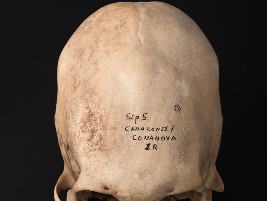 Cráneo con deformación anular oblicua, sitio Cxa E-6 (Conanoxa)