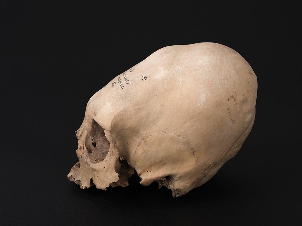 Cráneo con deformación anular oblicua, sitio Cxa E-6 (Conanoxa)
