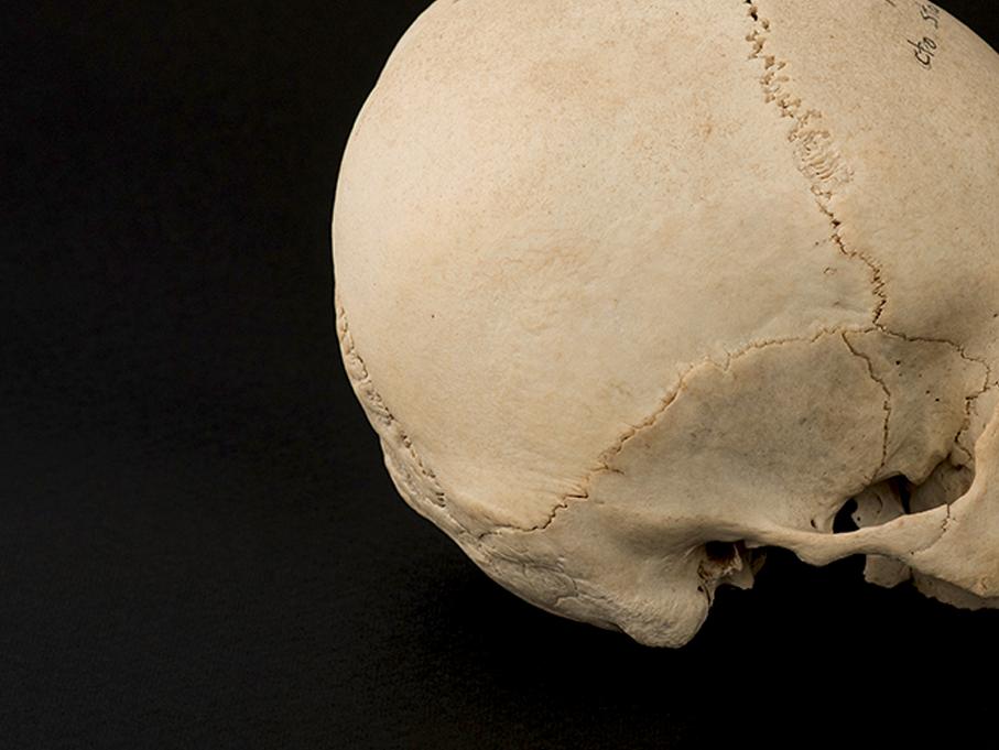 Cráneo con deformación tabular erecta, sitio Santa Rosita