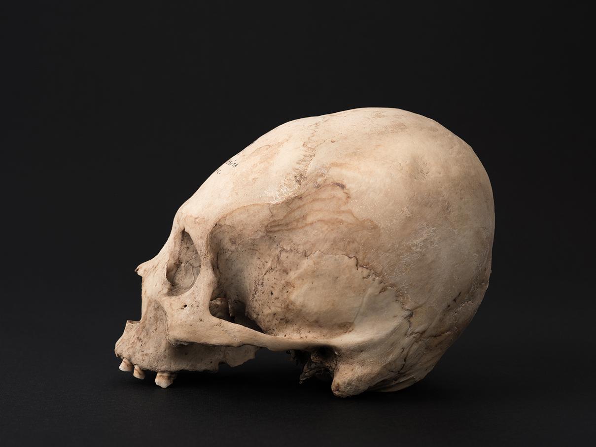 Cráneo con deformación tabular oblicua, sitio Santa Rosita