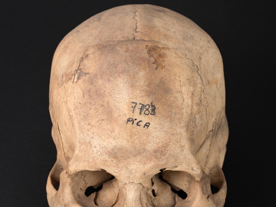 Cráneo con deformación anular oblicua, sitio Santa Rosita