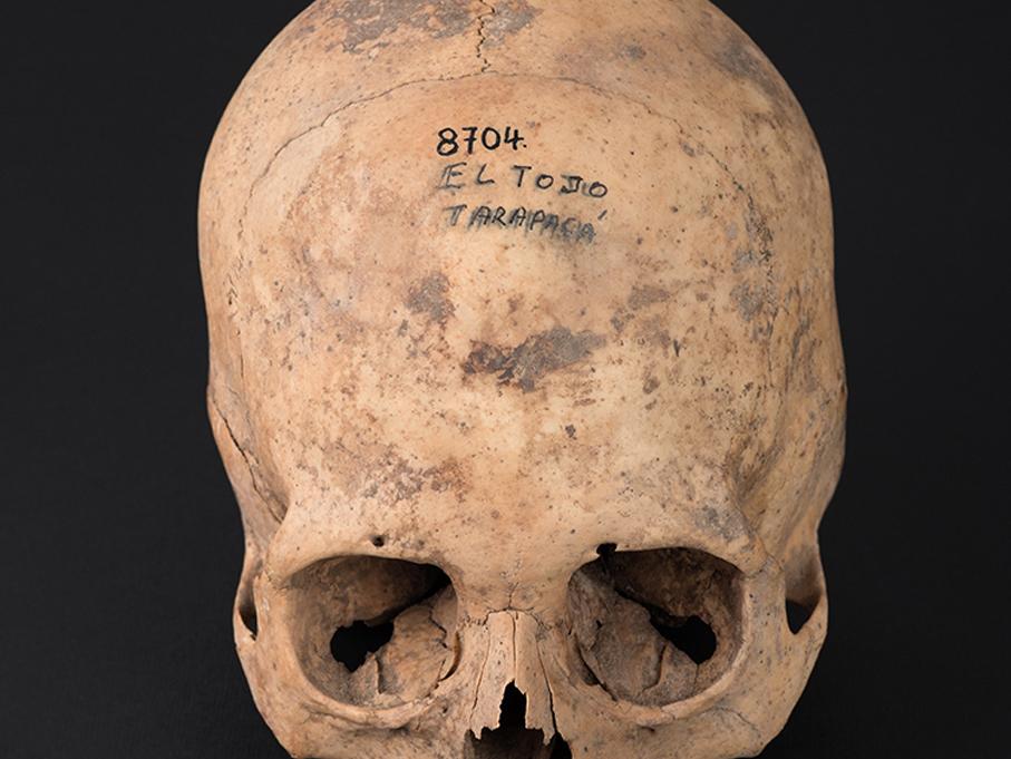 Cráneo con deformación anular erecta, sitio El Tojo