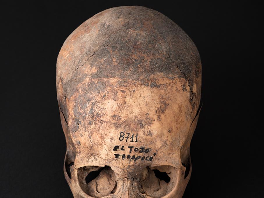 Cráneo con deformación anular oblicua, sitio El Tojo