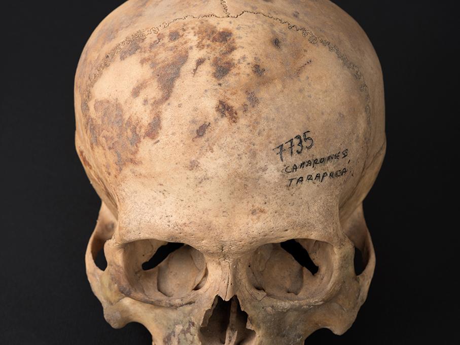 Cráneo con deformación tabular erecta, sitio Hacienda Camarones
