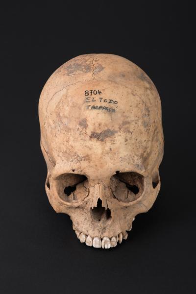 Cráneo con deformación anular erecta, sitio El Tojo Cráneo con deformación anular erecta, sitio El Tojo