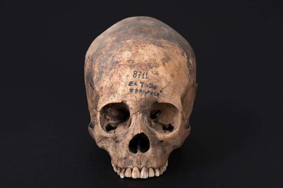 Cráneo con deformación anular oblicua, sitio El Tojo Cráneo con deformación anular oblicua, sitio El Tojo