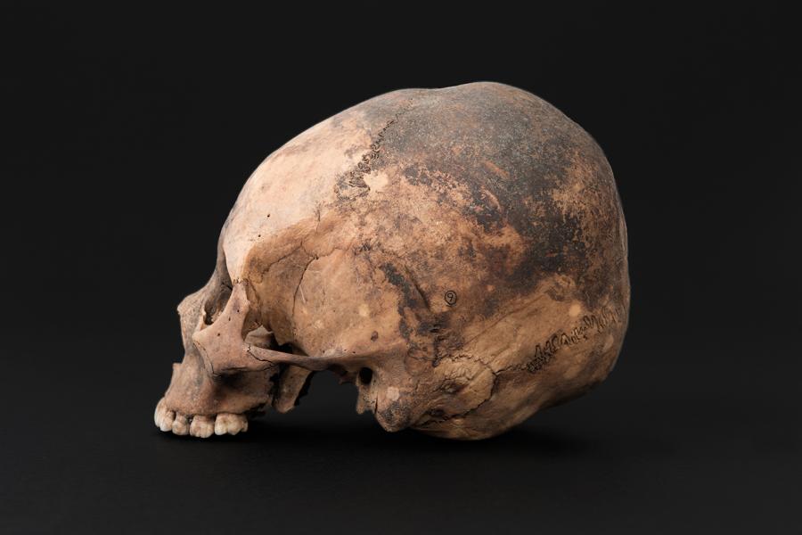 Cráneo con deformación anular oblicua, sitio El Tojo Cráneo con deformación anular oblicua, sitio El Tojo
