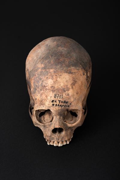 Cráneo con deformación anular oblicua, sitio El Tojo Cráneo con deformación anular oblicua, sitio El Tojo