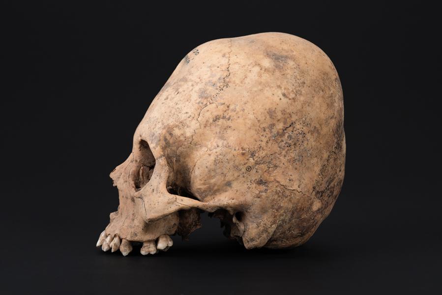 Cráneo con deformación anular erecta, sitio El Tojo