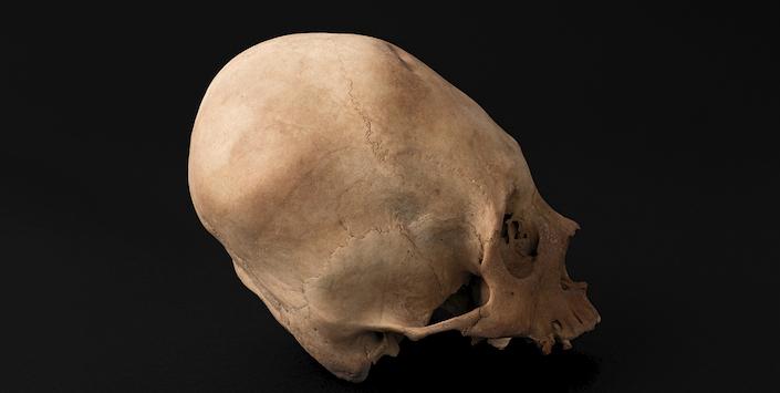 Cráneo con deformación anular erecta, sitio El Tojo Cráneo con deformación anular erecta, sitio El Tojo